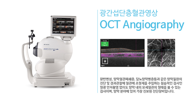 OCT Angiography (������������������)
